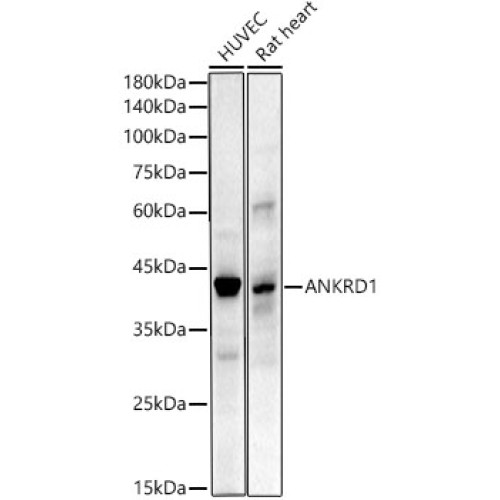 ANKRD1 Rabbit mAb