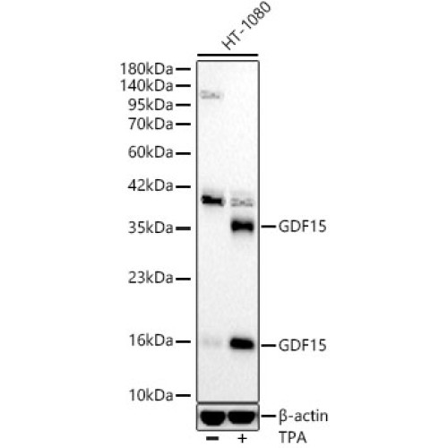 GDF15 Rabbit mAb