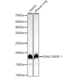 VSNL1/VILIP-1 Rabbit mAb