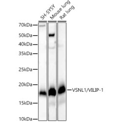 VSNL1/VILIP-1 Rabbit mAb