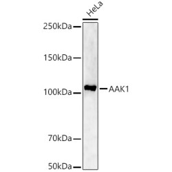 AAK1 Rabbit pAb