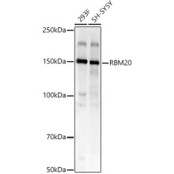 RBM20 Rabbit pAb