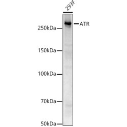 ATR Rabbit mAb