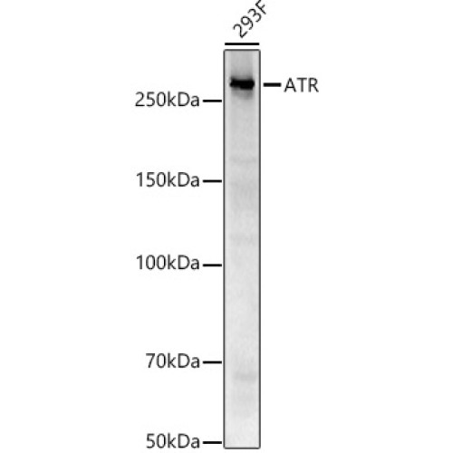 ATR Rabbit mAb
