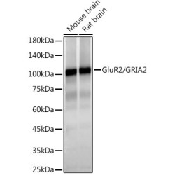 GluR2/GRIA2 Rabbit mAb