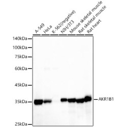 AKR1B1 Rabbit mAb