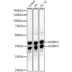 ALKBH5 Rabbit mAb