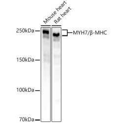 MYH7/β-MHC Rabbit mAb