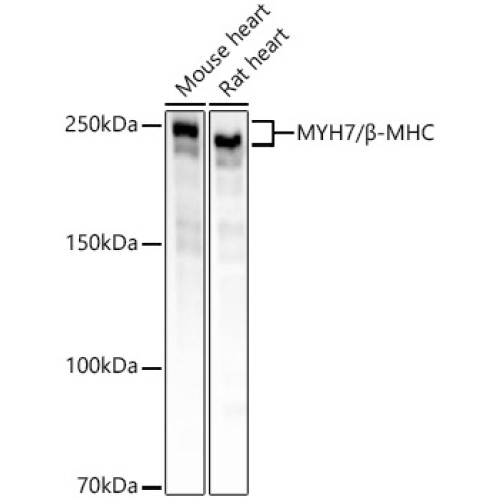 MYH7/β-MHC Rabbit mAb