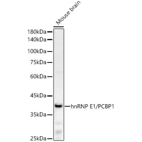 hnRNP E1/PCBP1 Rabbit mAb