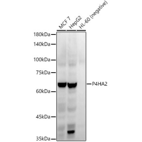 P4HA2 Rabbit mAb