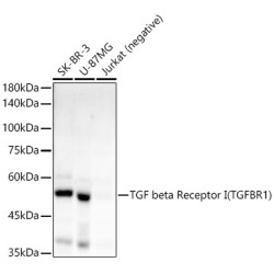 TGF beta Receptor I (TGFBR1) Rabbit mAb