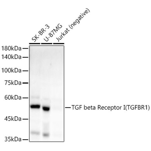 TGF beta Receptor I (TGFBR1) Rabbit mAb