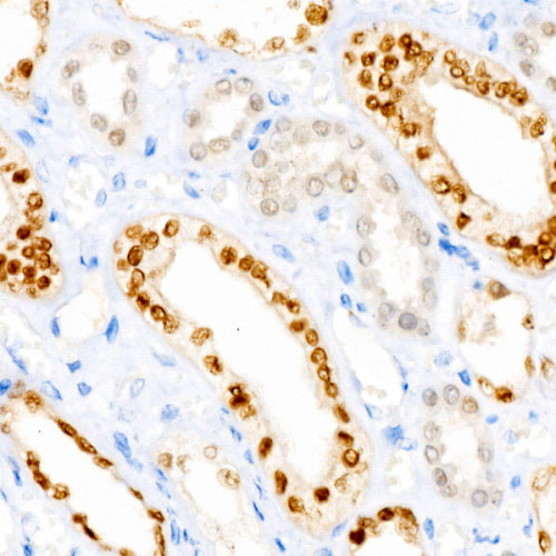PAX8 Rabbit mAb