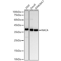 NACA Rabbit mAb
