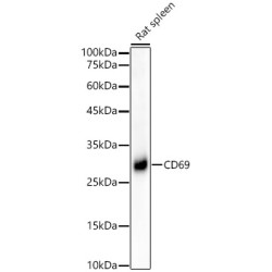 CD69 Rabbit mAb