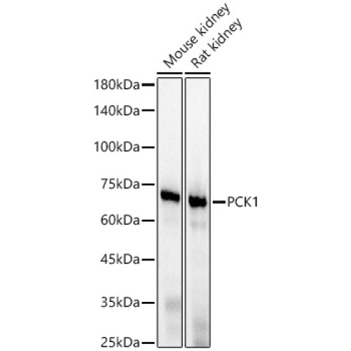 PCK1 Rabbit mAb