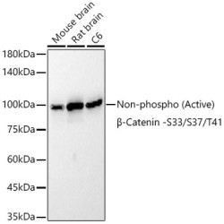 [KO Validated] Non-phospho (Active)β-Catenin -S33/S37/T41 Rabbit mAb