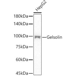 [KD Validated] Gelsolin Rabbit mAb