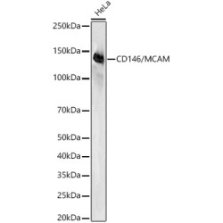 CD146/MCAM Rabbit mAb