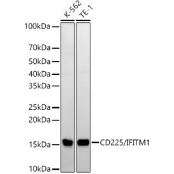 CD225/IFITM1 Rabbit mAb