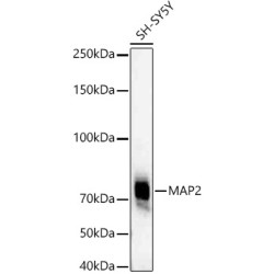 MAP2 Rabbit mAb