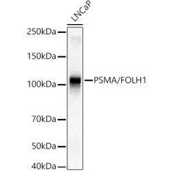 PSMA/FOLH1 Rabbit mAb