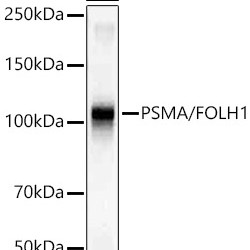 PSMA/FOLH1 Rabbit mAb