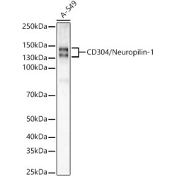 Neuropilin-1 (NRP1) Rabbit mAb