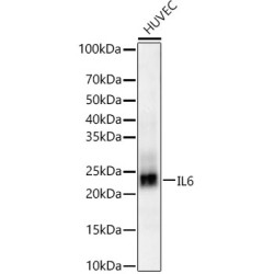 IL-6 Rabbit mAb