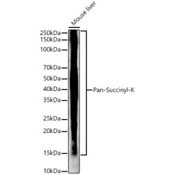 Pan-Succinyl-K Rabbit mAb