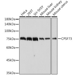CPSF73 Rabbit mAb