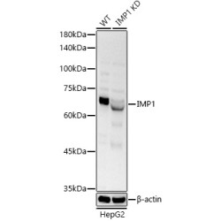[KO Validated] IGF2BP1/IMP1 Rabbit pAb