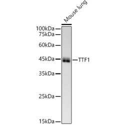 NKX2-1 Rabbit mAb
