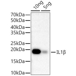 IL1β Rabbit mAb