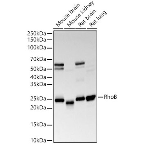RhoB Rabbit mAb