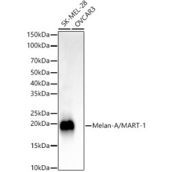 Melan-A/MART-1 Rabbit mAb