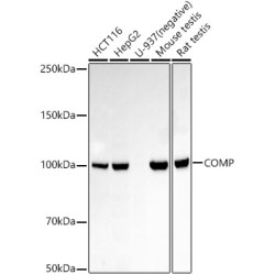 COMP Rabbit mAb