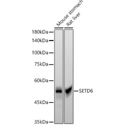 SETD6 Rabbit mAb