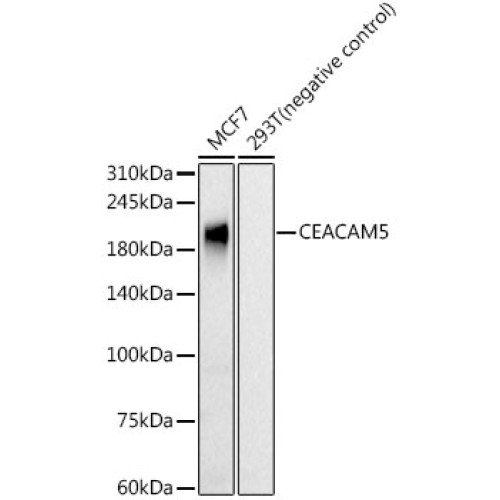 CEACAM5 Rabbit mAb