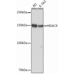 HDAC9 Rabbit mAb