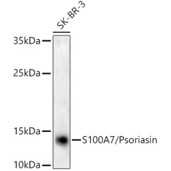 S100A7/Psoriasin Rabbit mAb