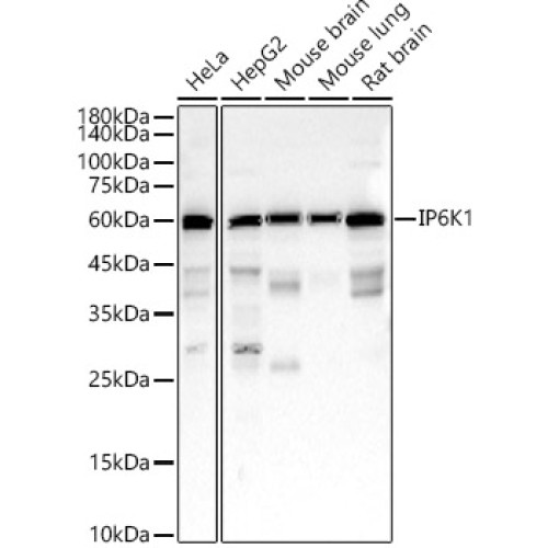 IP6K1 Rabbit mAb