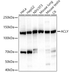 ACLY Rabbit mAb