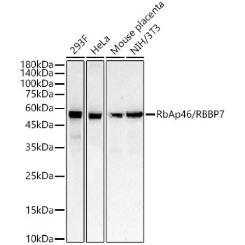 RbAp46/RBBP7 Rabbit mAb