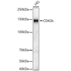 CD42b Rabbit mAb
