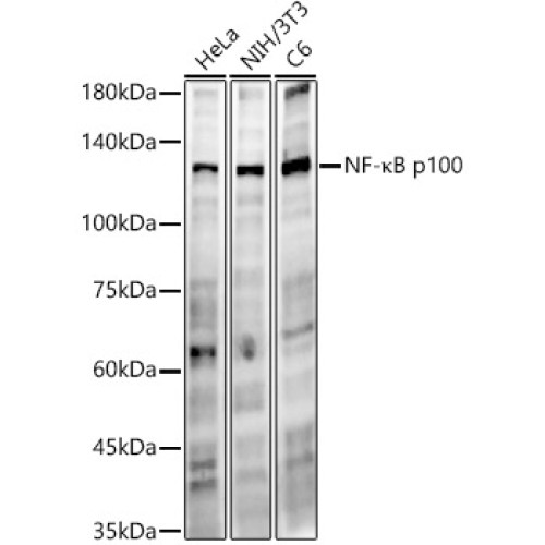 NF-κB2 Rabbit mAb