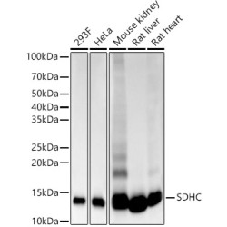 SDHC Rabbit mAb