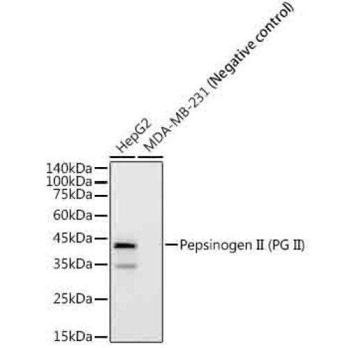 Pepsinogen II (PG II) Rabbit mAb