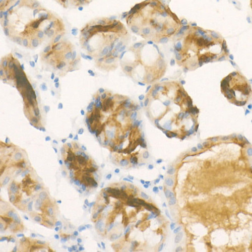 Pepsinogen II (PG II) Rabbit mAb